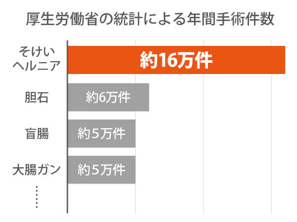 ope_graph_20210422_3